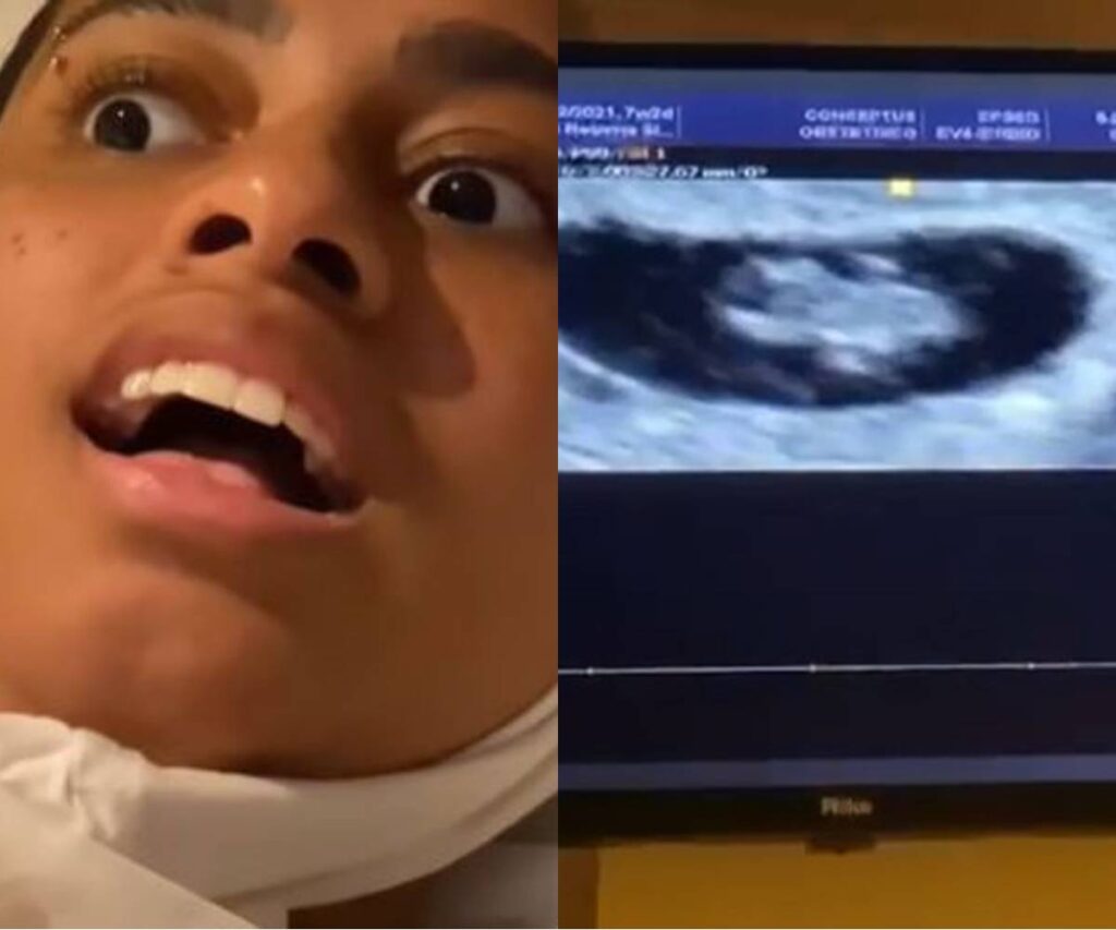 MC Loma fica surpresa ao ver o ultrassom do filho